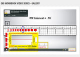 EKG Workbook Online Video Series 1